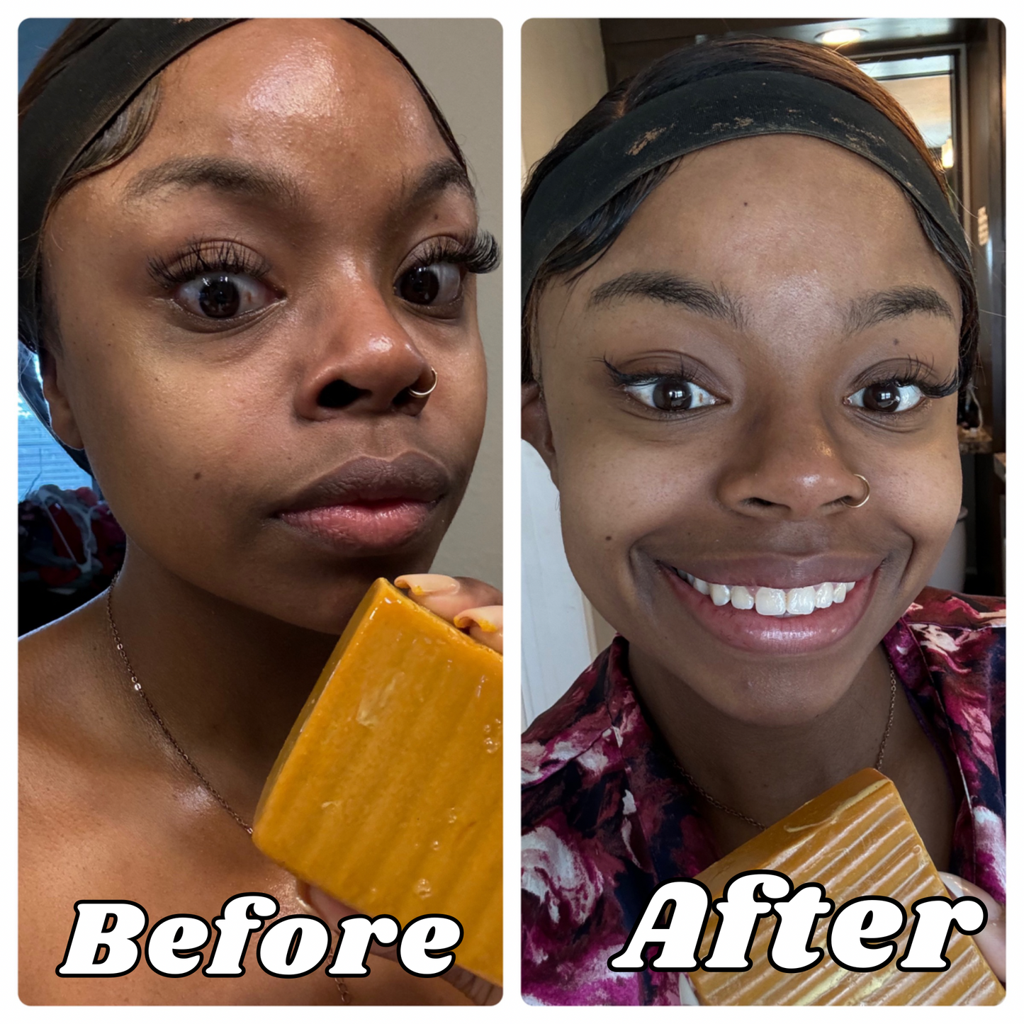 Turmeric Manuka Honey Brightening Soap Bars(PREORDER)